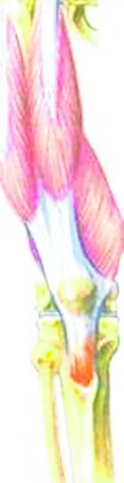 Tendinitis Rotuliana