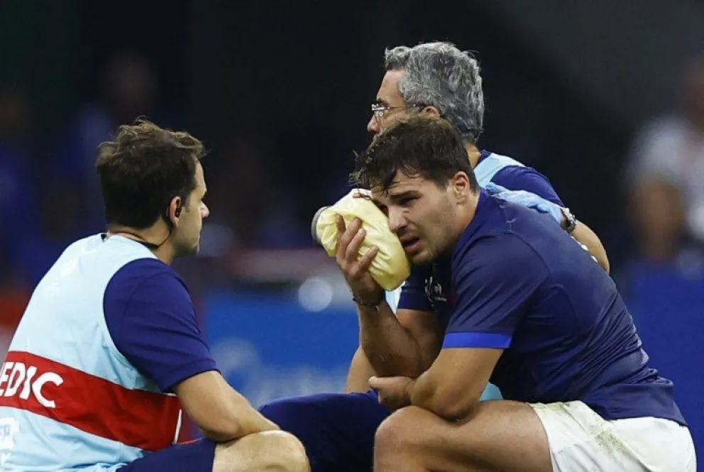 Una estrella francesa se recuperó en tiempo récord de una fractura en la cara y podría volver ante los Springboks
