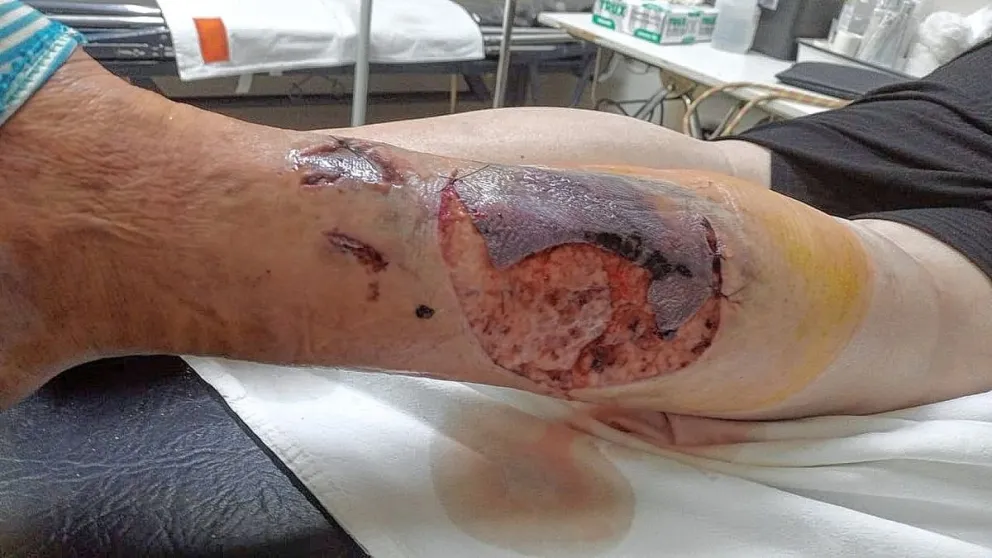 Una portera fue brutalmente atacada por dos perros pitbull en barrio Ceferino