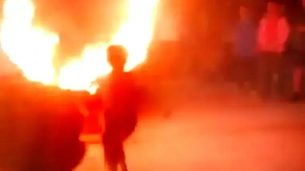 Una escuela hizo un acto con un aro de fuego y un niño sufrió quemaduras en sus piernas