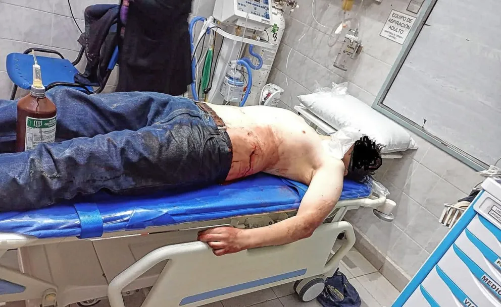 Llegó borracho y provocador a casa de sus “amigos” y terminó apuñalado