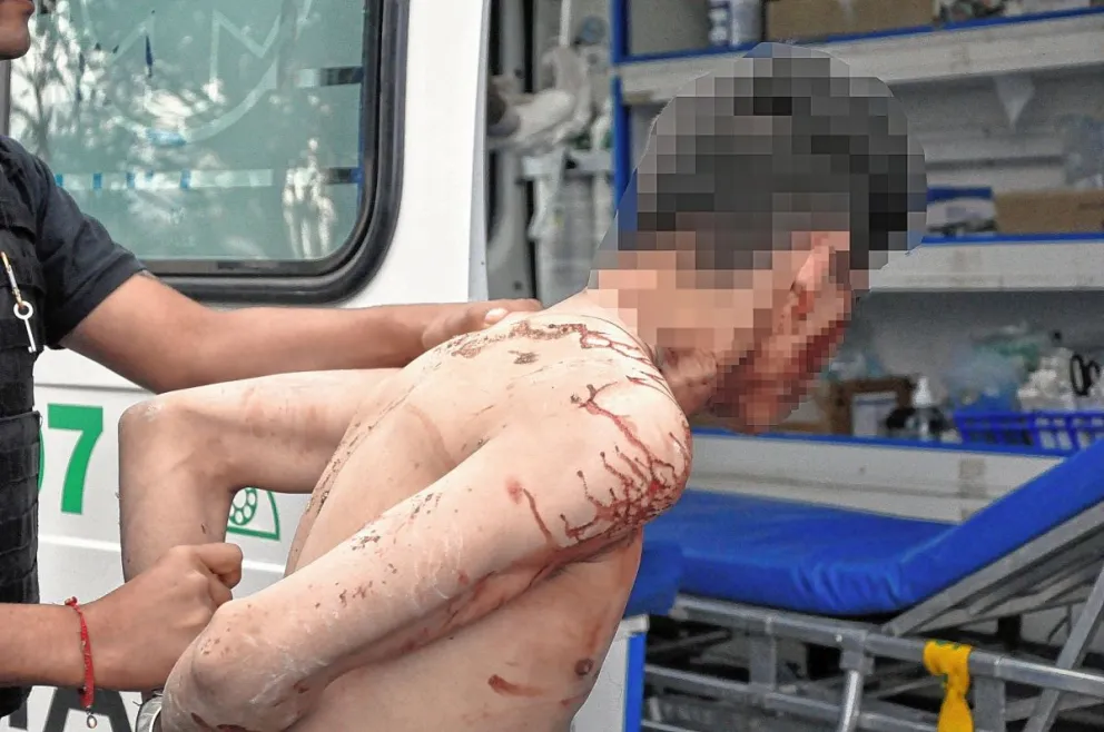 Entraron a robar a la casa de un policía y uno fue muy golpeado, aunque el policía también terminó hospitalizado