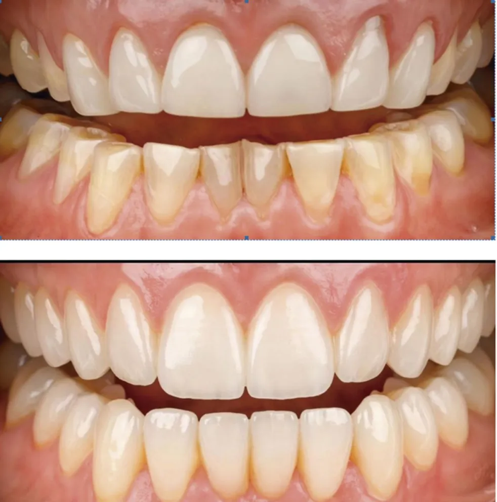 Sonrisa: Sinónimo de salud