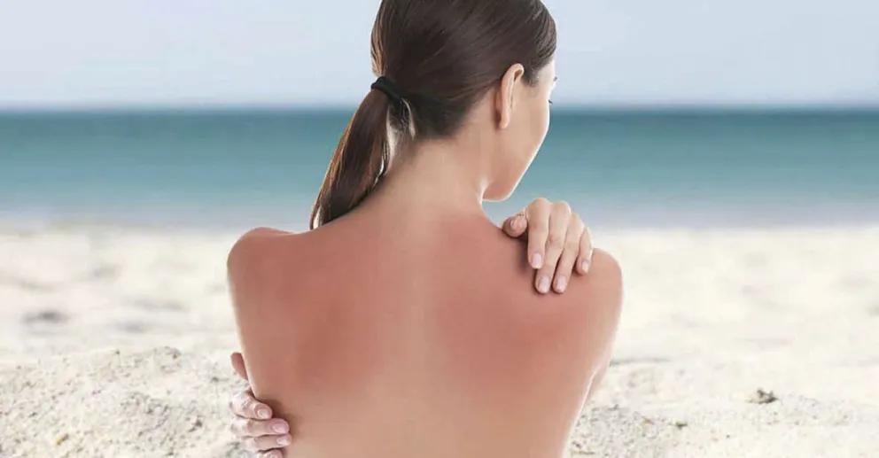 Consejos para cuidar nuestra piel en el verano