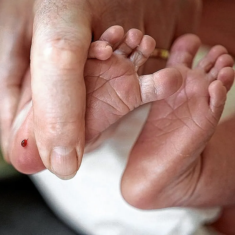 Día Mundial de las Enfermedades Poco Frecuentes: destacan la importancia de que se cumpla el Programa Nacional de Pesquisa Neonatal