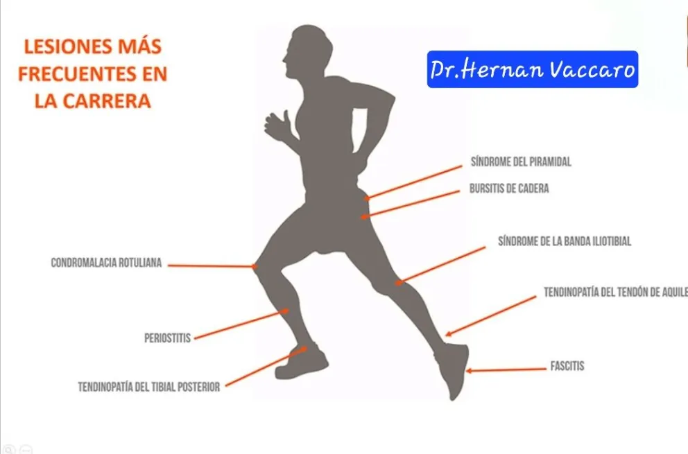 Lesiones comunes en  corredores de la Patagonia