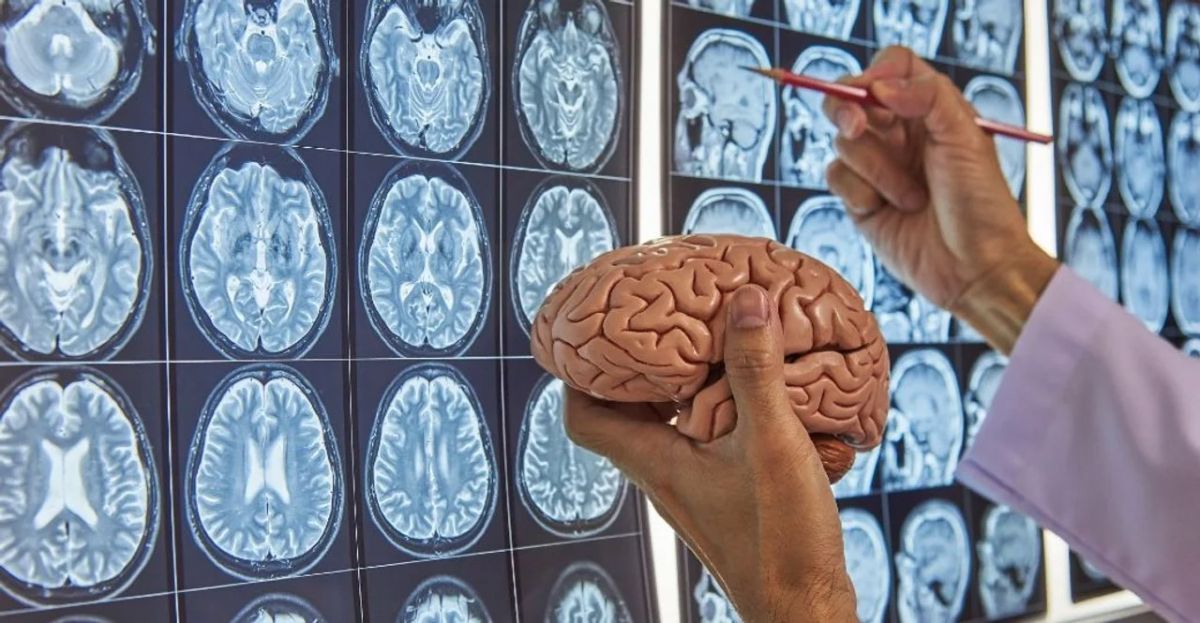 Avanza vacuna personalizada contra el tumor cerebral más letal: resultados prometedores