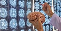 Avanza vacuna personalizada contra el tumor cerebral más letal: resultados prometedores