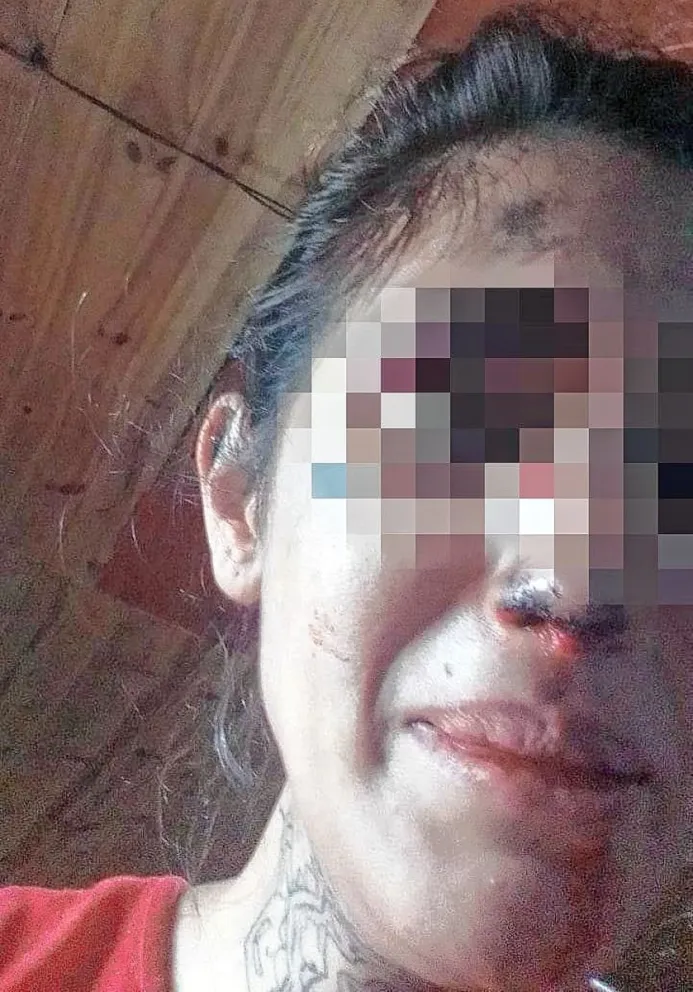 Golpeó a su expareja con una plancha de cocina en el rostro: piden que sea detenido 