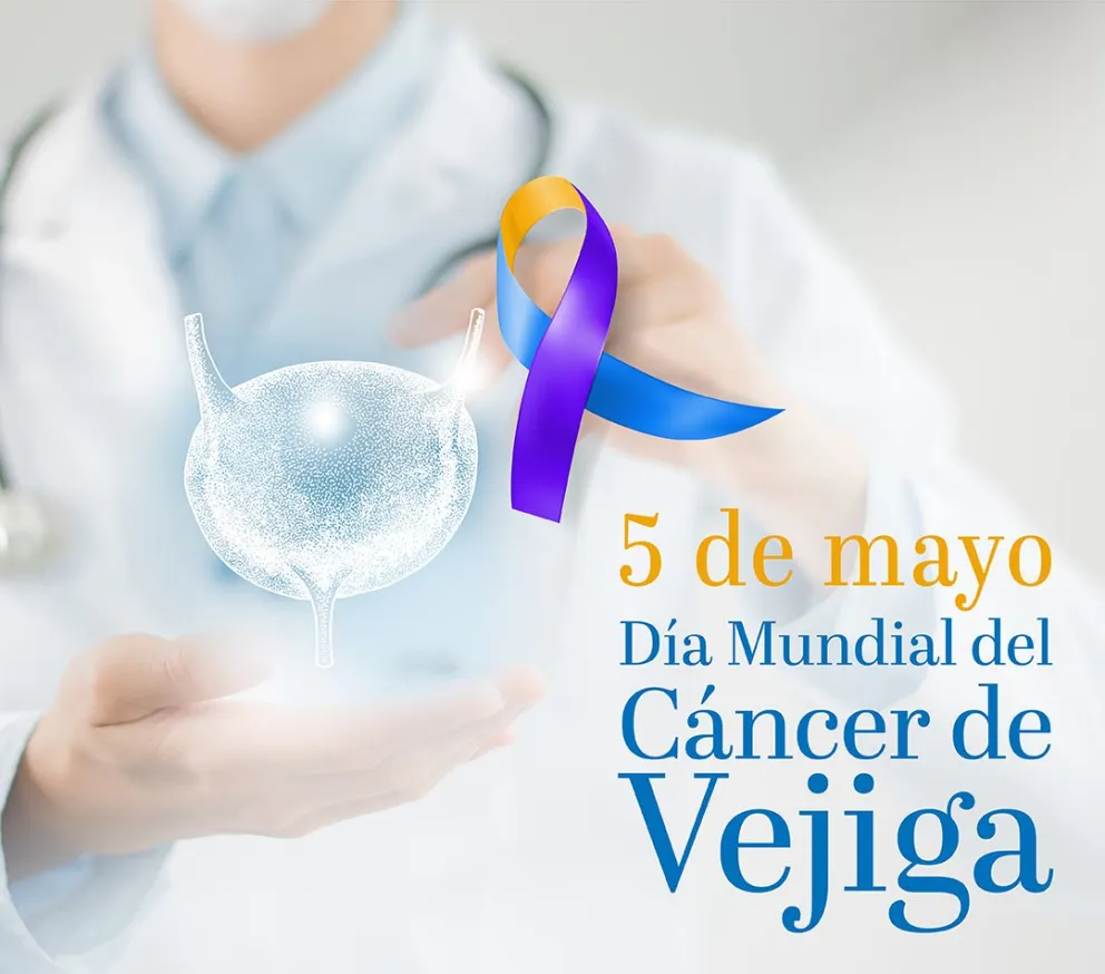 Casi 4 mil argentinos por año son diagnosticados con cáncer de vejiga