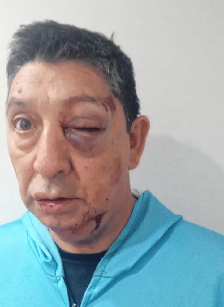 El fútbol de veteranos en exposición mediática por agresión a un árbitro