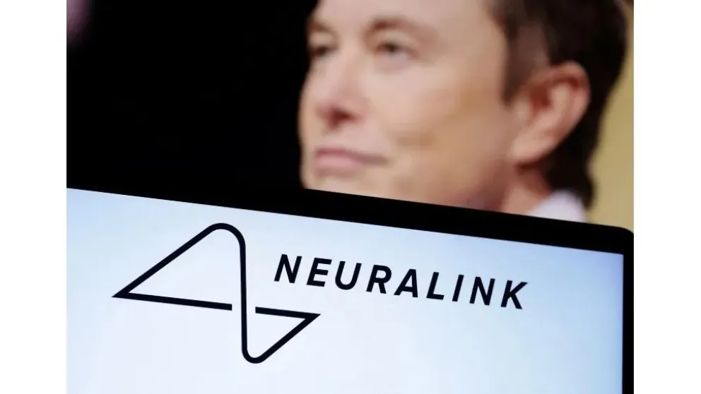 Neuralink y su chip cerebral: qué opina la comunidad científica