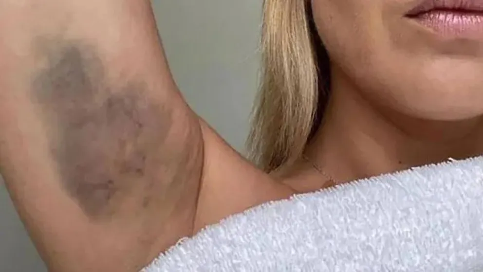 Las fotos y la denuncia de Fabiola Yañez en el expediente contra Alberto Fernández: “Venís golpeándome hace tres días seguidos”