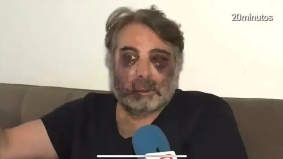 España: Les pidió silencio a los vecinos y como respuesta lo desfiguraron a golpes