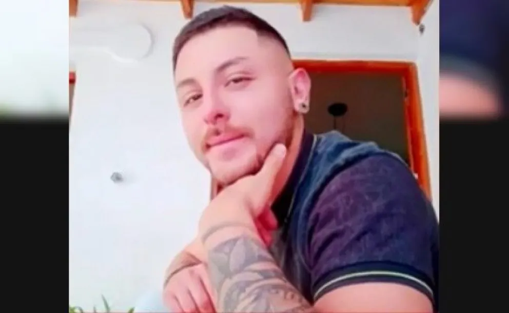 Falleció el joven argentino que contrajo viruela del mono en México