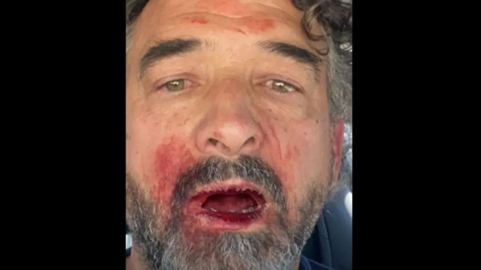 Salvaje agresión contra ex intendente en el municipio de Puerto Pirámides