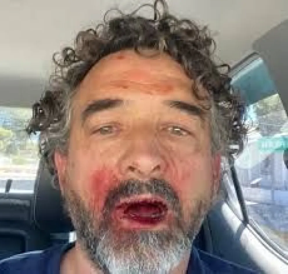 Se intenta “bajar decibeles” tras  la violenta golpiza contra Albaini