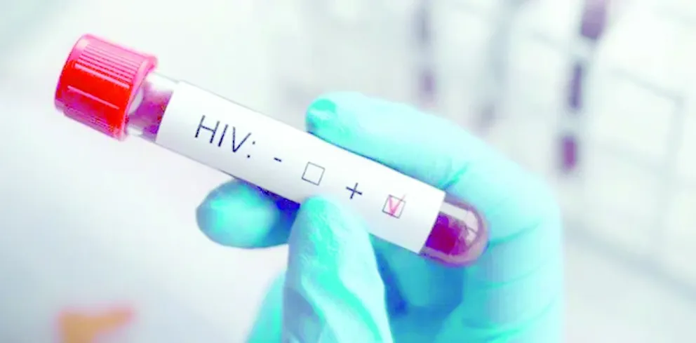 Grave ajuste de Milei en salud: faltan reactivos para medir carga viral de VIH