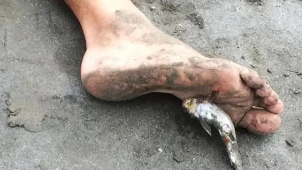 ¡A tener cuidado en la costa de Playa Unión! Vuelven los bagres y recomiendan no meterse al mar descalzo