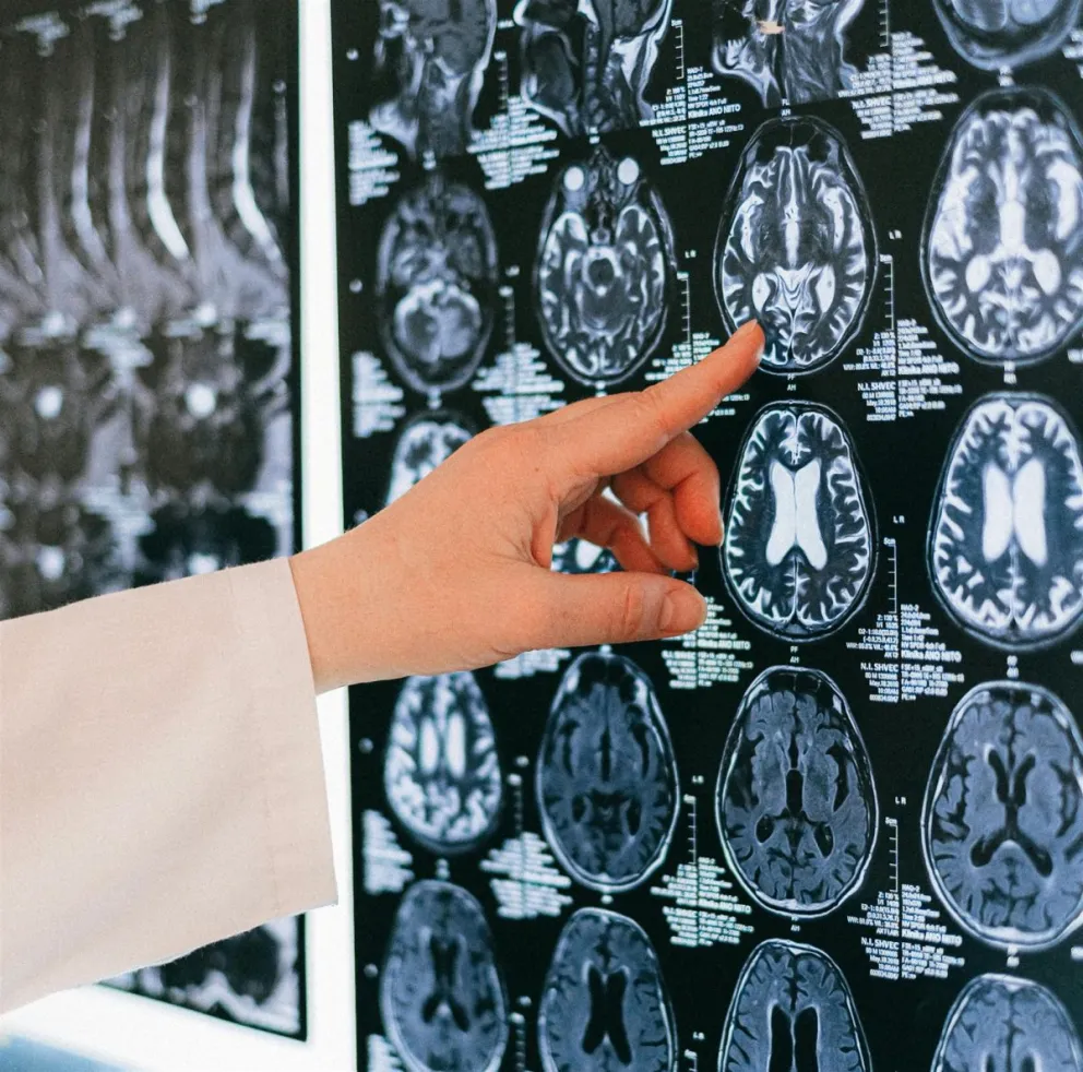 Avances contra los trastornos de la conciencia