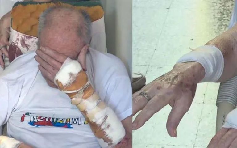 Delincuentes torturaron brutalmente a un jubilado: "Dame dólares o te doy corriente"