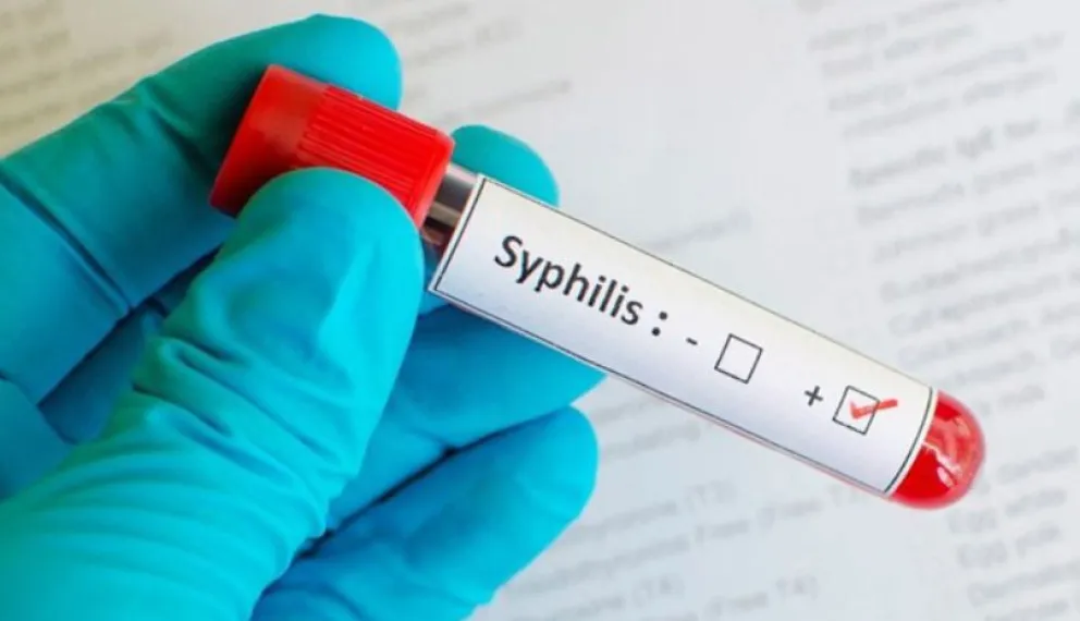 Revelan claves sobre el origen y la expansión de la sífilis en América