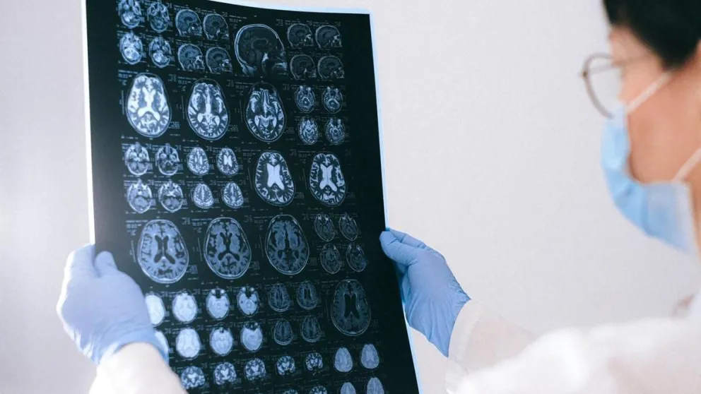 Avances en el estudio del GPS del cerebro