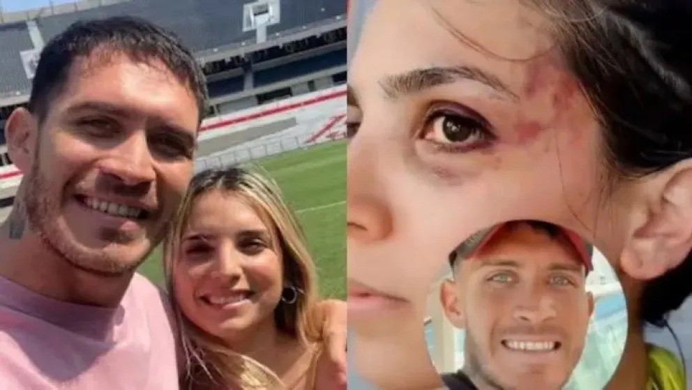 Video: Emily Ceco revela sus heridas tras el presunto ataque de su esposo, Santiago Martínez