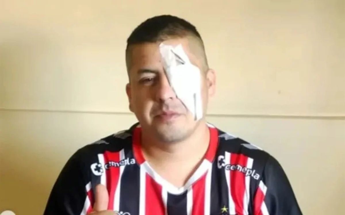 Un hincha de Chacarita perdió un ojo en la represión en el Congreso y denunció a Bullrich