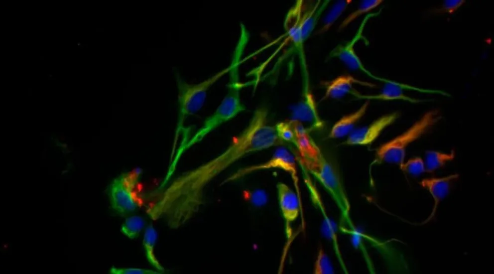 Científicos del CONICET desarrollan una terapia biológica para tratar el Parkinson, neuronas y astrocitos, imagen de microscopía de fluorescencia