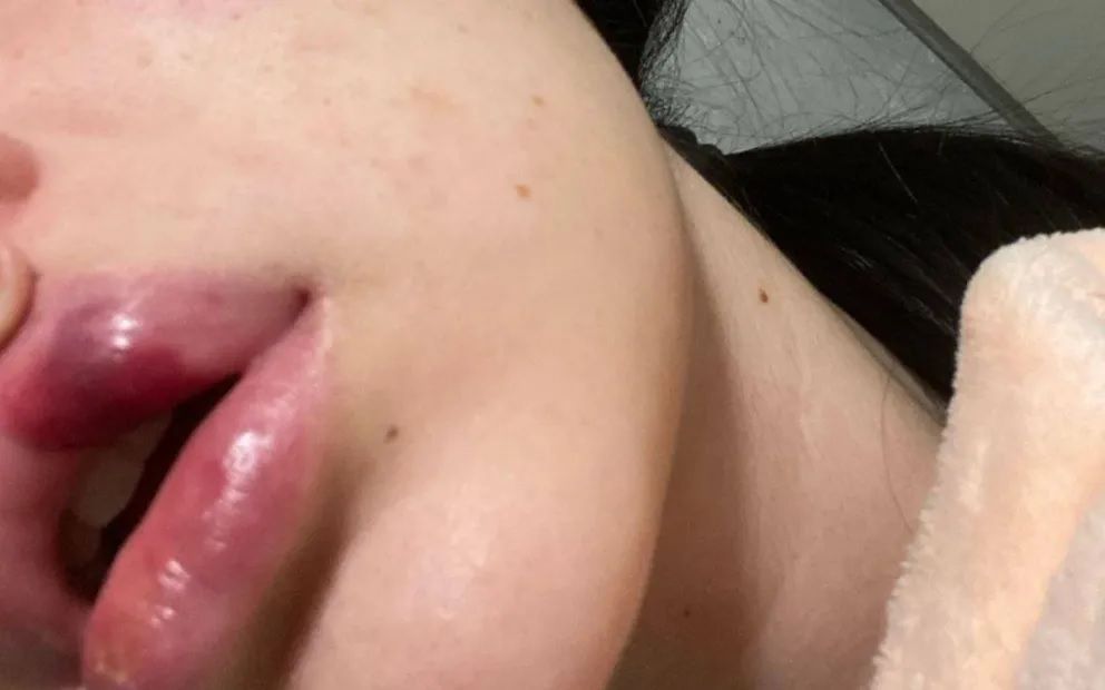 El lunes movilizarán para exigir Justicia por la joven agredida por su expareja en Standard Norte