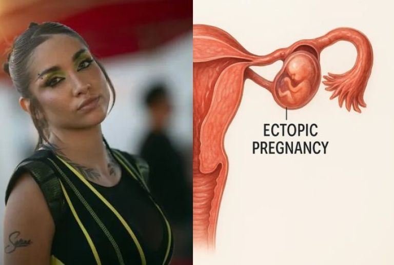 Qué es un embarazo ectópico, la complicación médica que casi le cuesta la vida a María Becerra