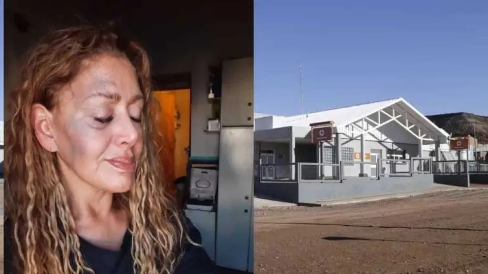 Violento ataque a una médica en Añelo 