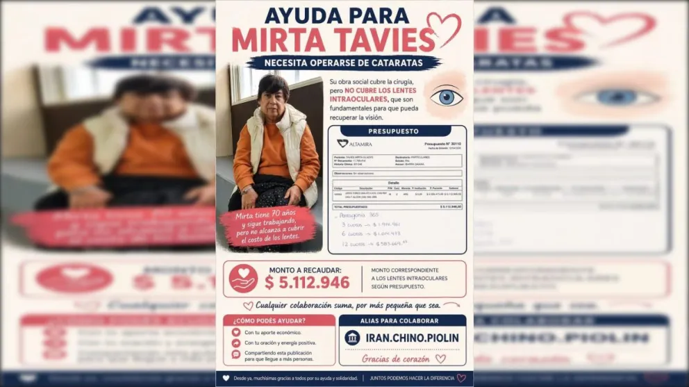 Piden ayuda para Mirta Tavies: necesita operarse de cataratas y no puede pagar los lentes intraoculares