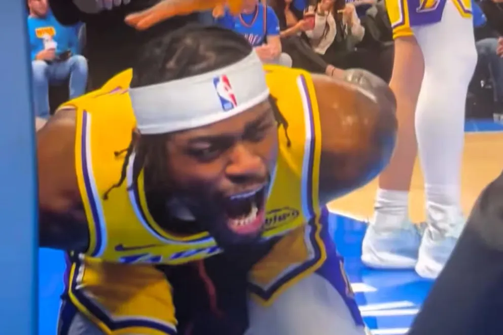 Jarred Vanderbilt, el jugador de Los Angeles Lakers que sufrió una dolorosa lesión en el dedo meñique de su mano izquierda.