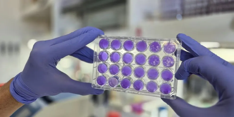 Científicos argentinos hallan mecanismo universal en virus del dengue y Zika